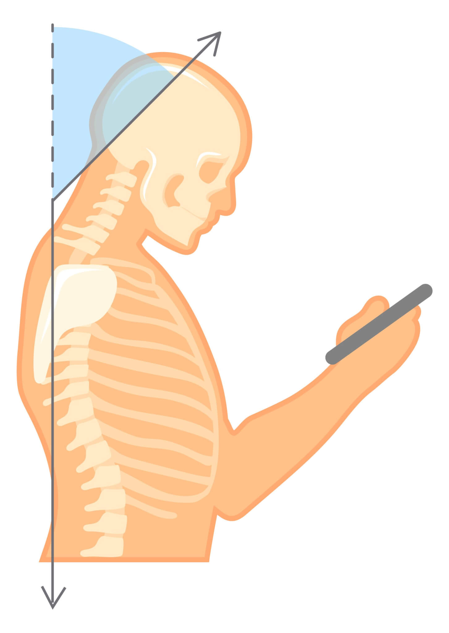 Illustrazione posture sbagliate colonna cervicale